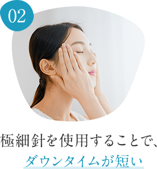 02 極細針を使用することで、ダウンタイムが短い