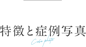 特徴と症例写真
